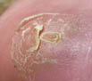 Sept 2010 wound