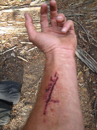 Arm gouge and scrapes from fording mishap
