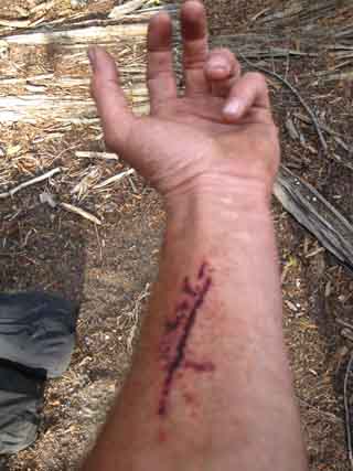 Wound taken making ford