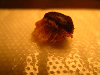 Bone fragment, the other side.