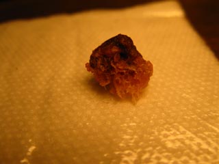Bone fragment