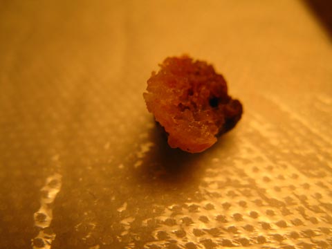 Bone fragment, bottom view.